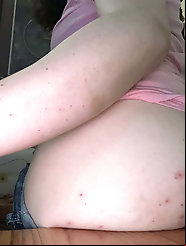 Anyone want a Bite??